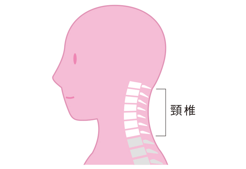 ■頸椎の「クッション」のズレやつぶれが凝りや痛みの原因に