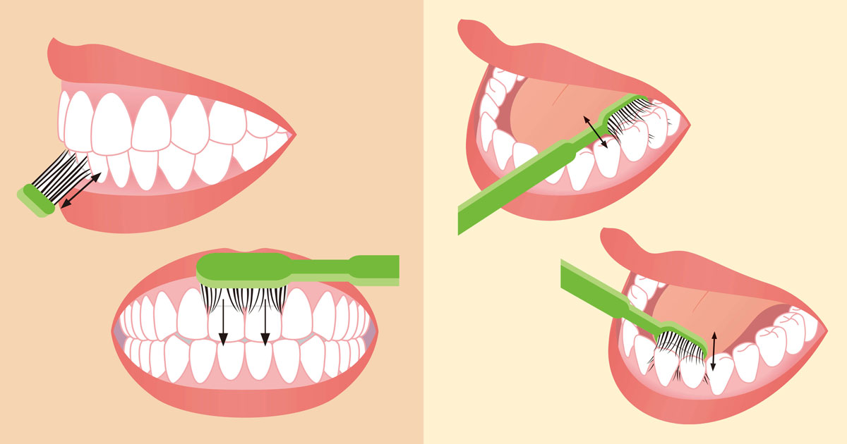 歯周病予防の つまようじ磨き 1週間で歯ぐきが若返る 日経xwoman