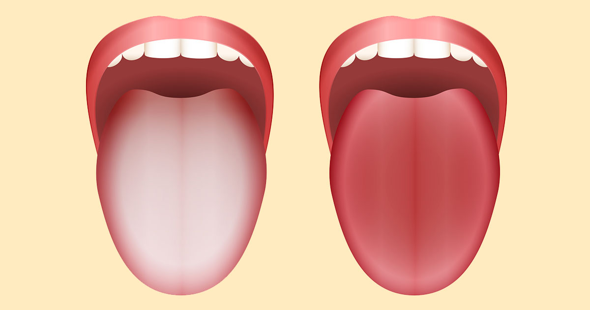 舌 点 赤ちゃん 黒い 舌に黒い点が出来た！原因や症状、舌の色で分かる健康状態を知ろう！